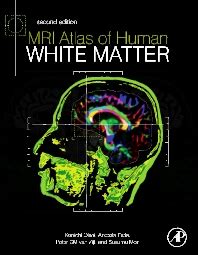 mri atlas of human white matter second edition PDF