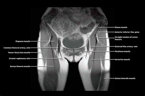 mri of the female and male pelvis Epub