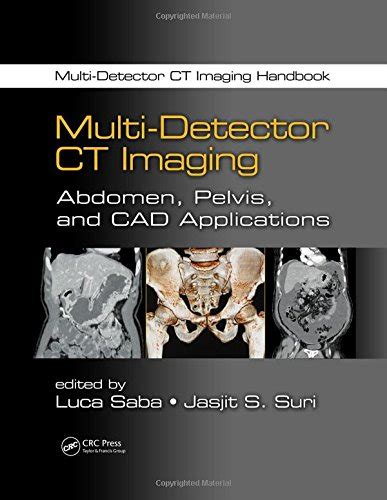 multi detector ct imaging handbook two volume set Doc