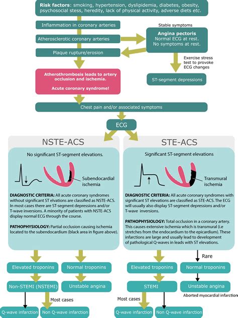 Myocardial Infarction Chart