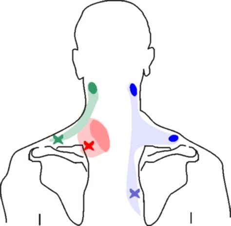 neck and shoulder pain on left side