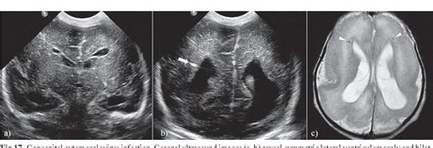 neonatal cerebral ultrasound neonatal cerebral ultrasound Kindle Editon