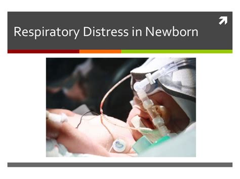 neonatal respiratory distress syndrome world wide Kindle Editon
