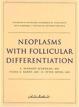 neoplasms with follicular differentiation ackermans histologic diagnosis of neoplastic skin diseases a method Reader