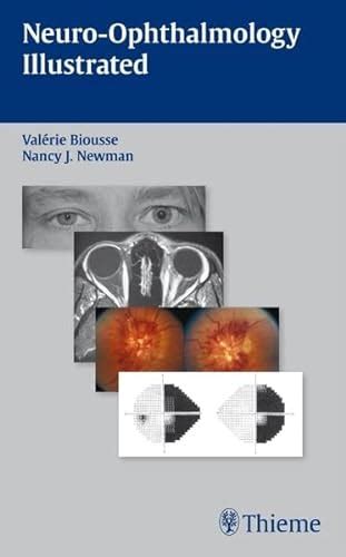 neuro ophthalmology illustrated valerie biousse PDF