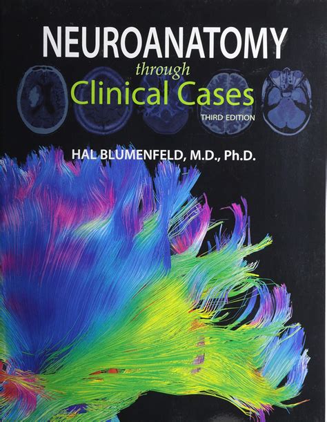 neuroanatomy through clinical cases second edition with Ebook PDF