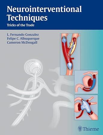 neurointerventional techniques tricks of the trade Epub