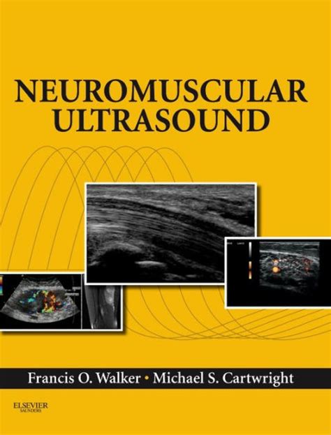 neuromuscular ultrasound expert consult online and print 1e Reader