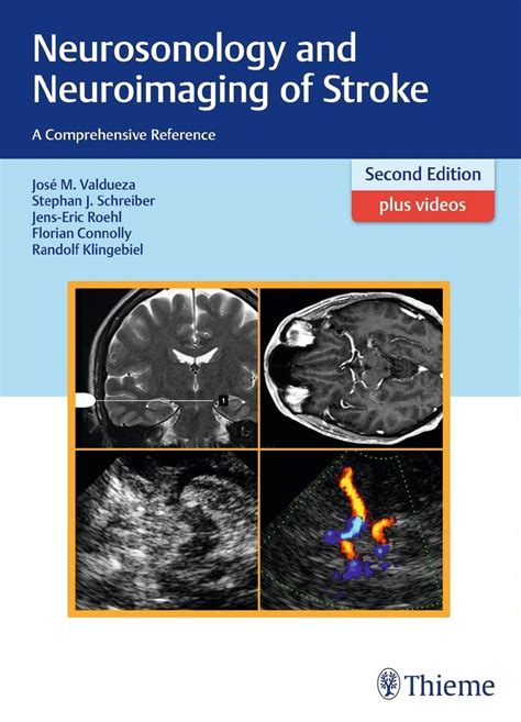 neurosonology and neuroimaging of stroke Kindle Editon