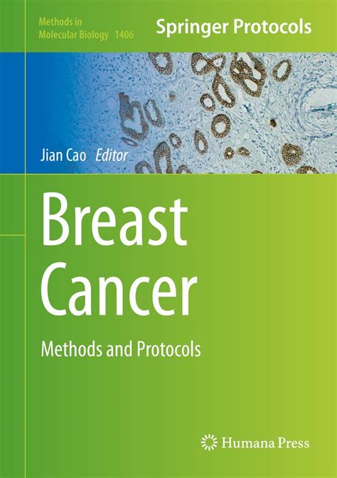 nice book breast cancer methods protocols molecular PDF