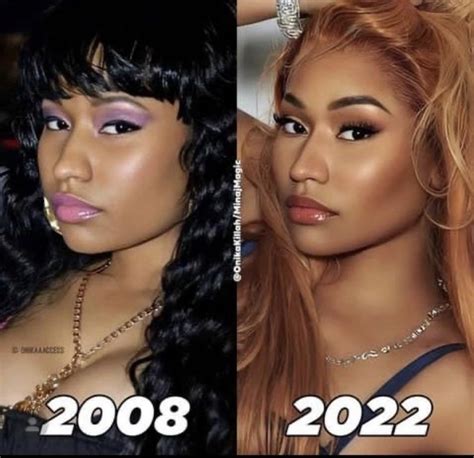 nicki minaj after and before