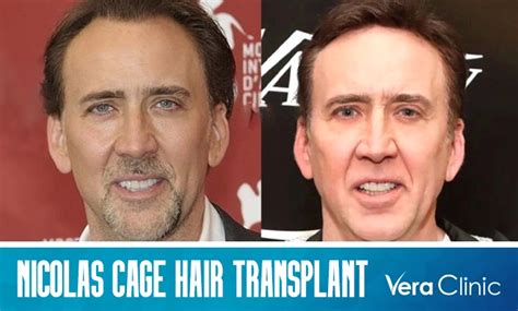 nicolas cage hair