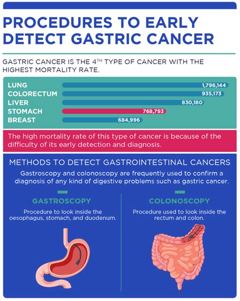 non invasive applications detect gastric cancer Reader