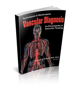 noninvasive vascular diagnosis noninvasive vascular diagnosis Reader