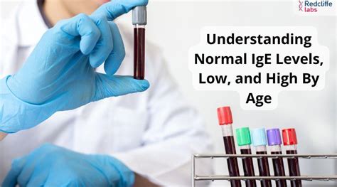 normal ige levels by age