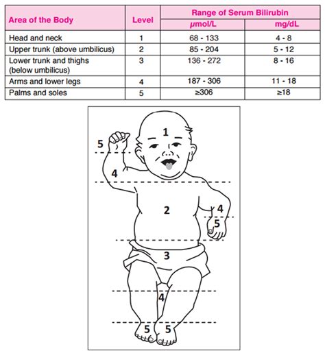 normal range of jaundice in newborn