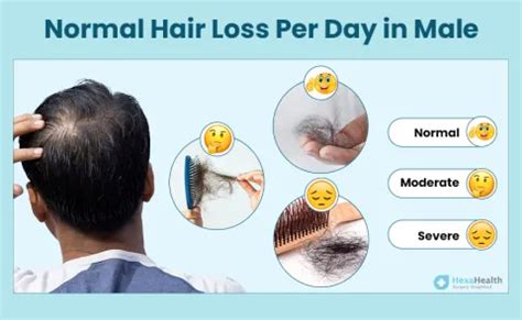 number of hair fall per day