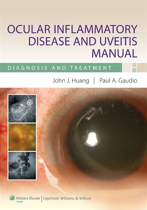 ocular inflammatory disease and uveitis manual PDF