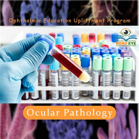 ocular pathology ocular pathology Kindle Editon