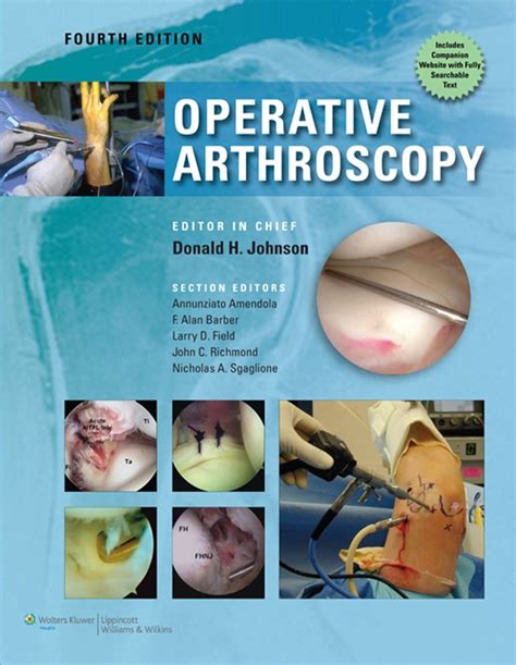 operative arthroscopy Kindle Editon