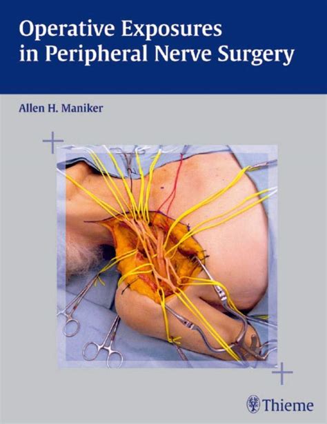 operative exposures in peripheral nerve surgery Kindle Editon