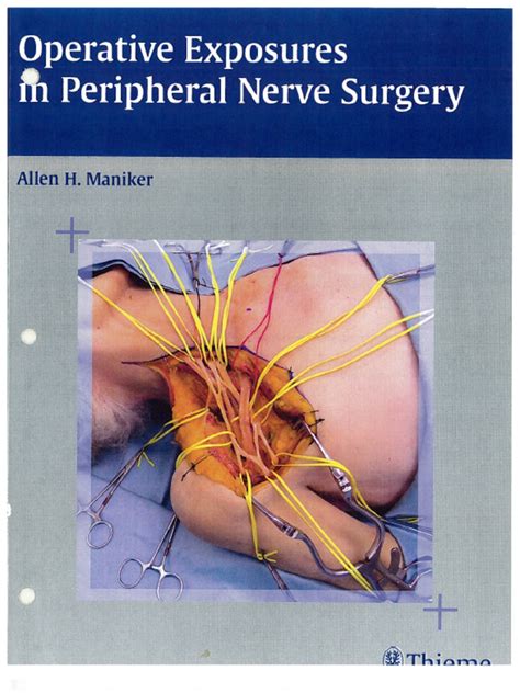 operative exposures in peripheral nerve surgery Kindle Editon