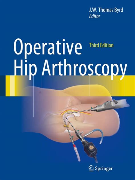 operative hip arthroscopy byrd operative hip arthroscopy Epub