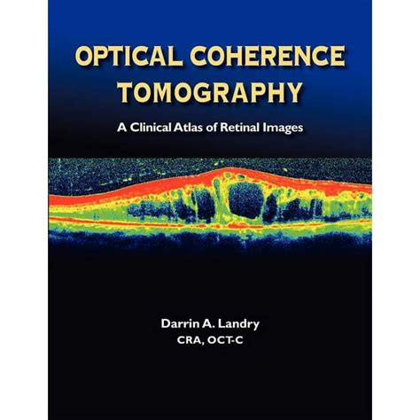 optical coherence tomography a clinical atlas of retinal images PDF