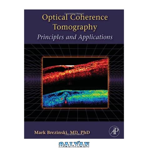 optical coherence tomography principles and applications PDF