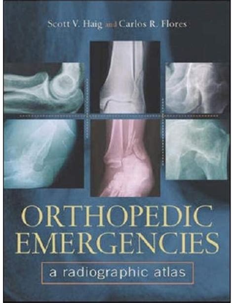 orthopedic emergencies a radiographic atlas Epub