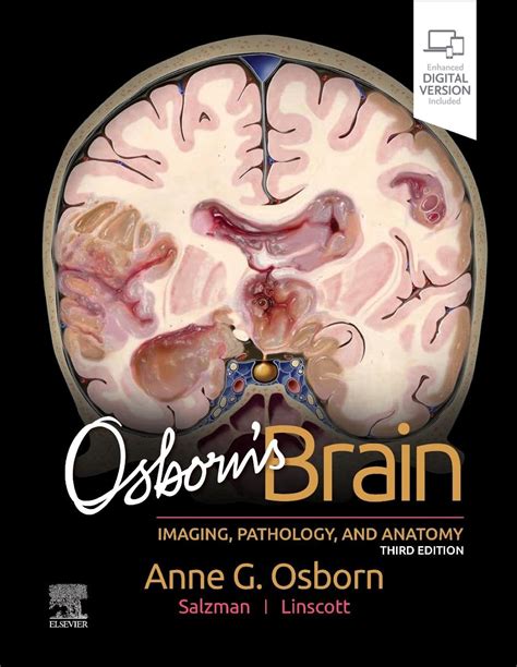 osborns brain imaging pathology and anatomy PDF