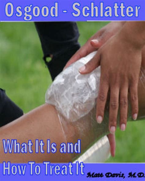 osgood schlatter what it is and how to treat it save your copay Doc