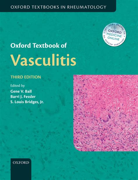 oxford textbook of vasculitis Ebook Kindle Editon