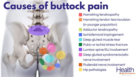 pain in lower back and buttocks when sitting