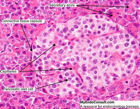 pancreatic islet complex