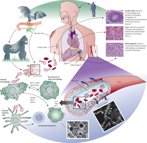pathology and pathogenesis of human viral disease Reader