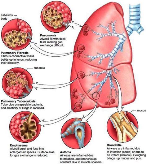 pathology of respiratory system