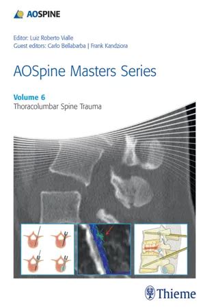pdf book aospine masters thoracolumbar spine trauma Doc