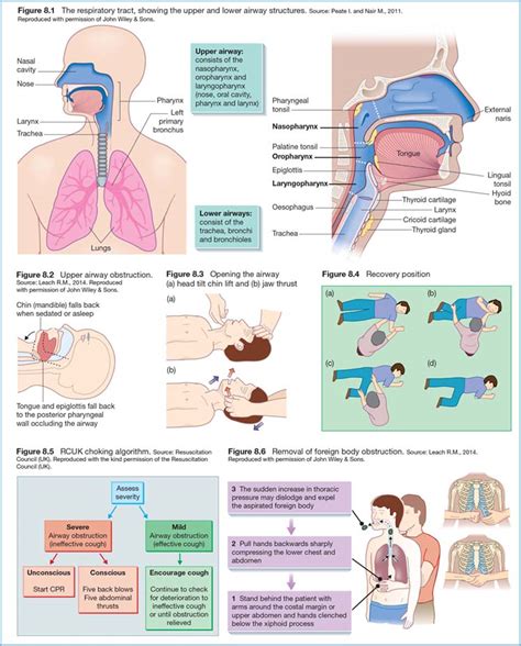 pdf free principles of airway Epub