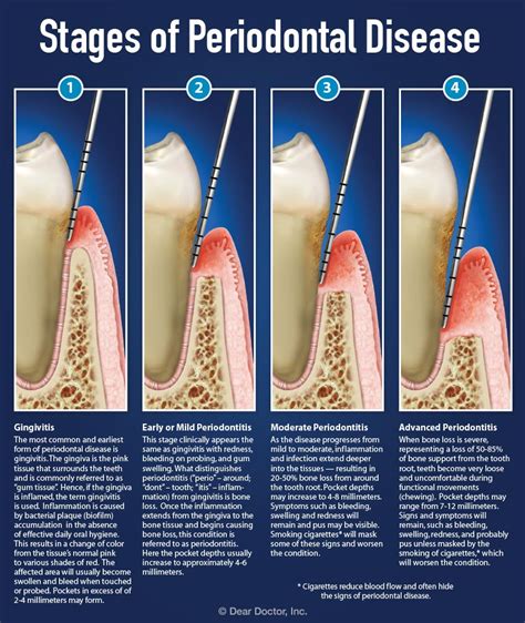 pdf free reversing gum disease Epub