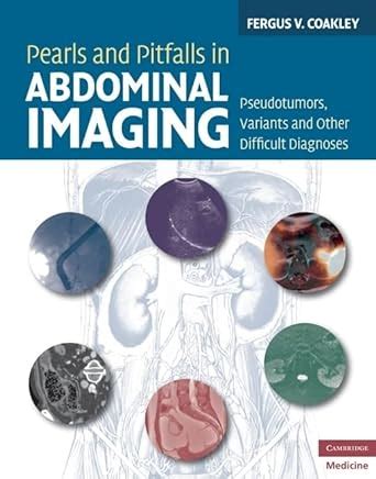 pearls and pitfalls in abdominal imaging pseudotumors variants and other difficult diagnoses Epub