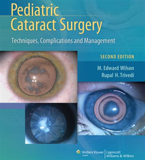 pediatric cataract surgery Ebook Epub