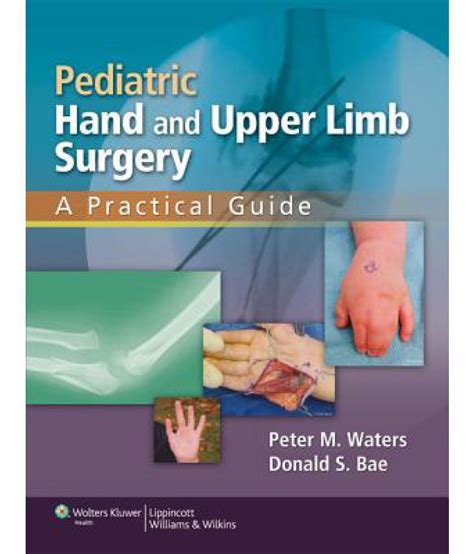 pediatric hand and upper limb surgery a practical guide PDF