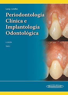 periodoncia clinica lindhe Ebook Doc