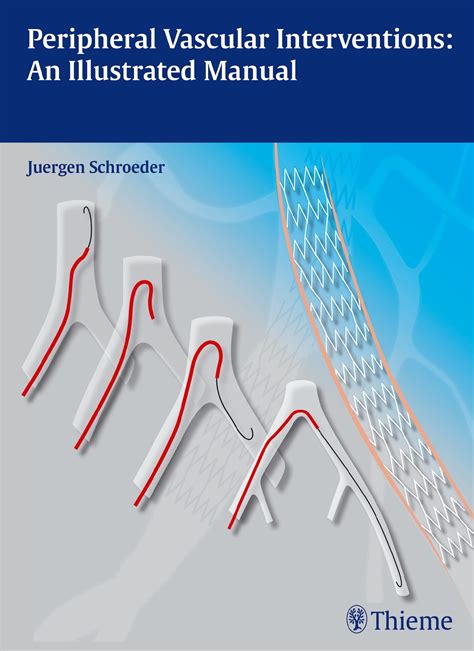 peripheral vascular interventions an illustrated manual Reader