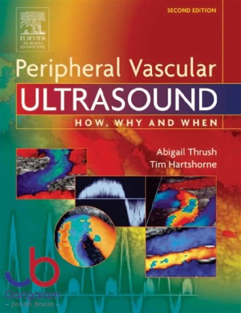 peripheral vascular ultrasound how why and when 2e Reader