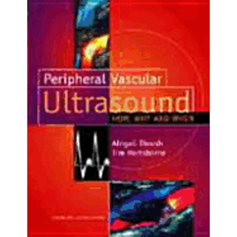 peripheral vascular ultrasound how why and when 2e Reader