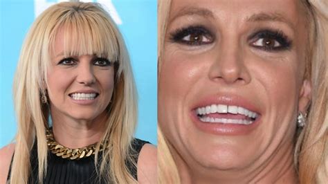 Britney Braces #12