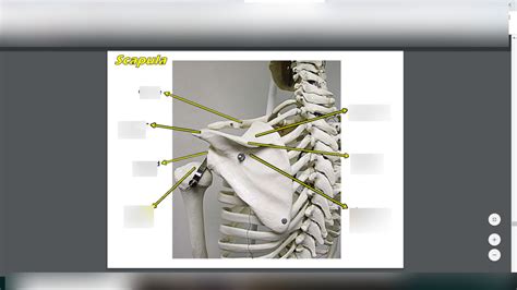 Dalya Bone #15
