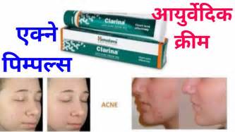 pimple ke daag ke liye medical cream Doc